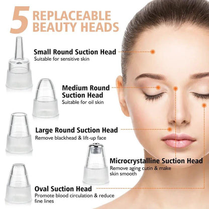 5-in-1 Blackhead Remover Vacuum | Deep Pore Cleaner & Acne Tool